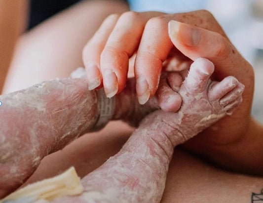 Vernix; the white coating of a newborn, why is it integral for health?